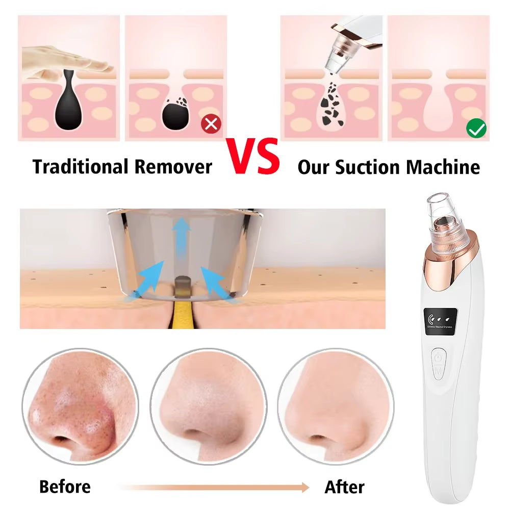 Blackhead Remover Vacuum Pore Adsorber Face Cleaner Electric Pimple Acne Black Head Removal Rechargeable Face Cleaning Tool